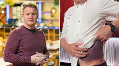 gordon ramsay accident what happened.